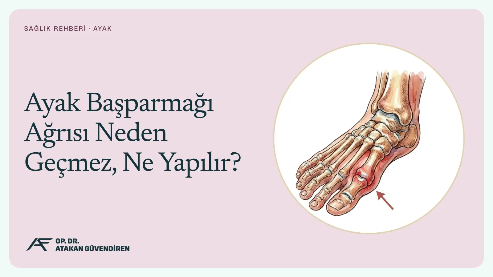 Ayak Başparmağı Ağrısı Neden Geçmez, Ne Yapılır?