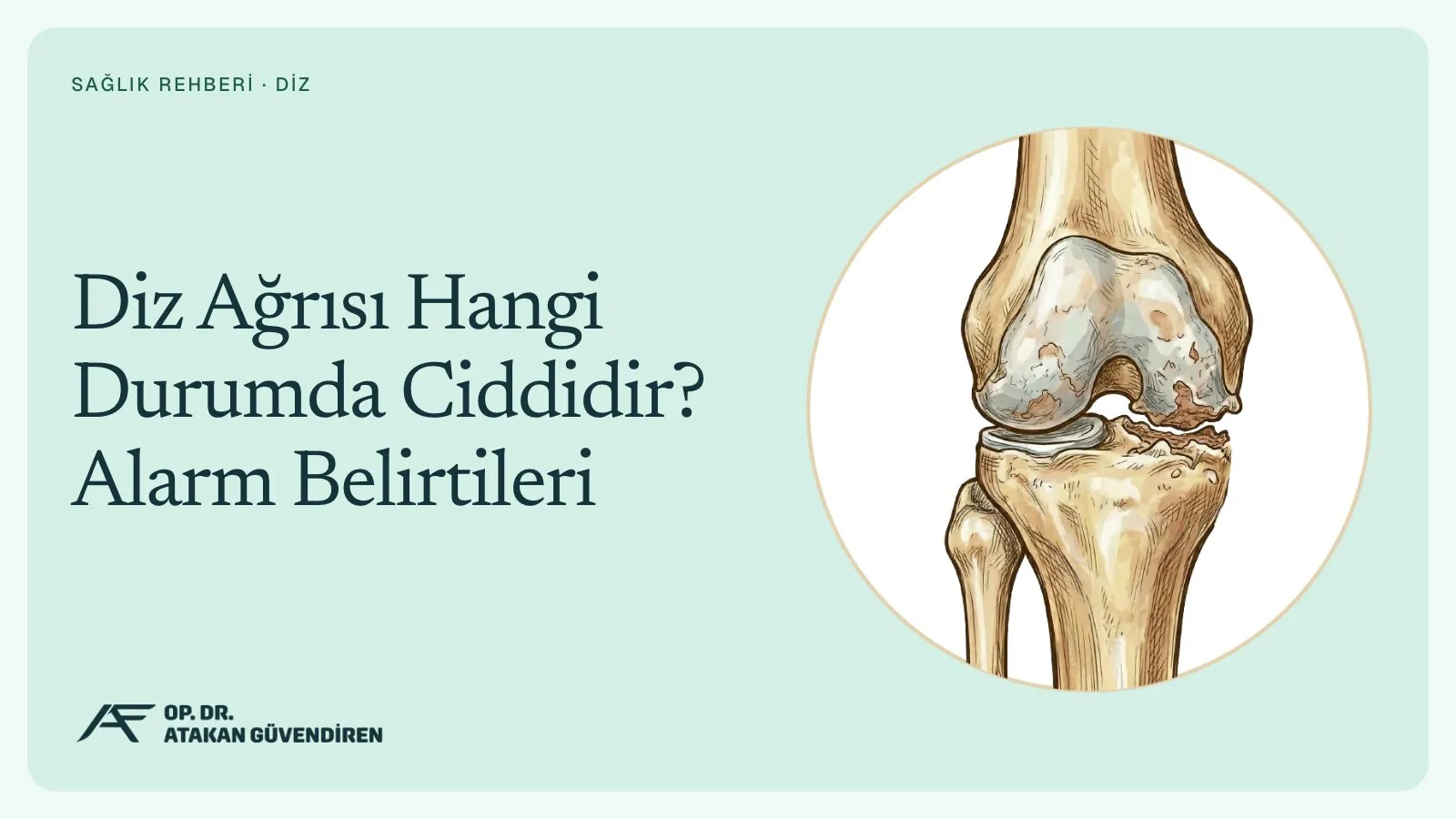 Diz Ağrısı Hangi Durumda Ciddidir? Alarm Belirtileri