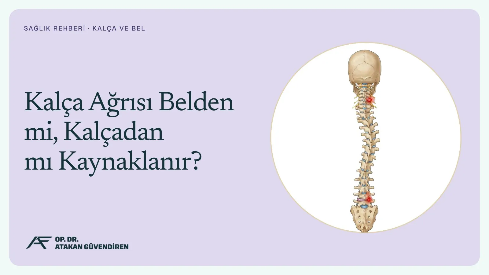 Kalça Ağrısı Belden mi, Kalçadan mı Kaynaklanır?