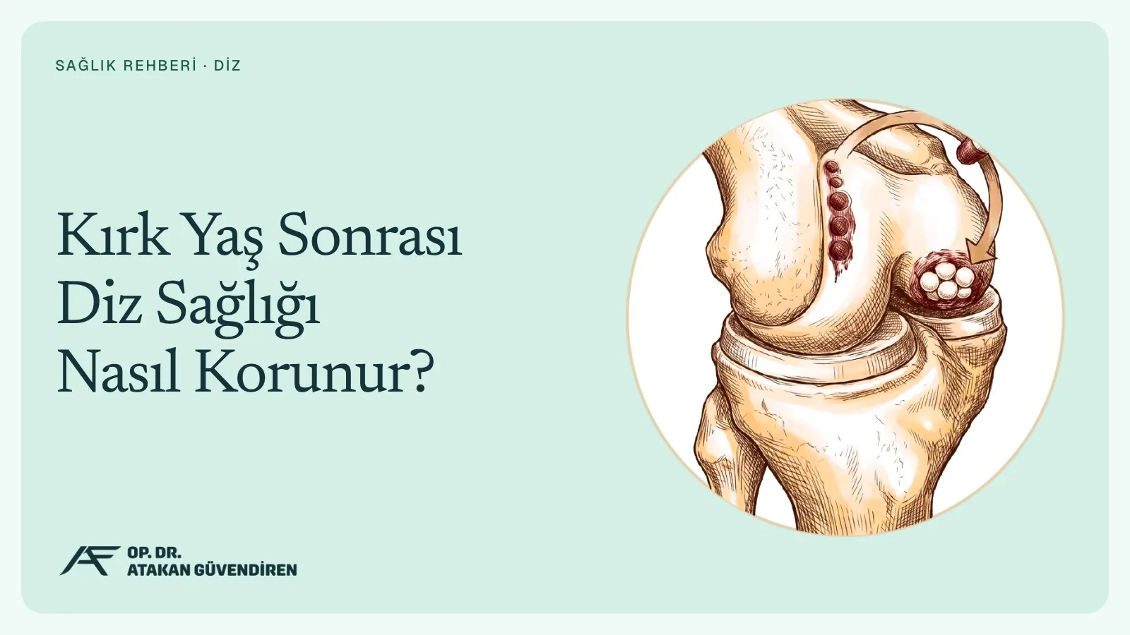 Kırk Yaş Sonrası Diz Sağlığı Nasıl Korunur?