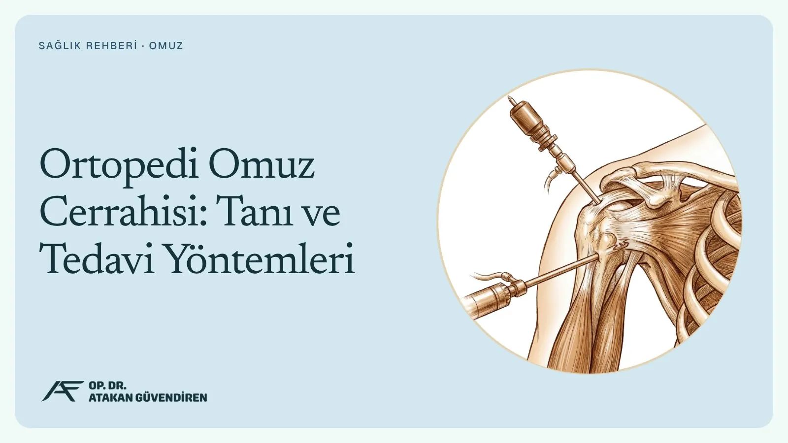 Ortopedi Omuz Cerrahisi: Tanı ve Tedavi Yöntemleri