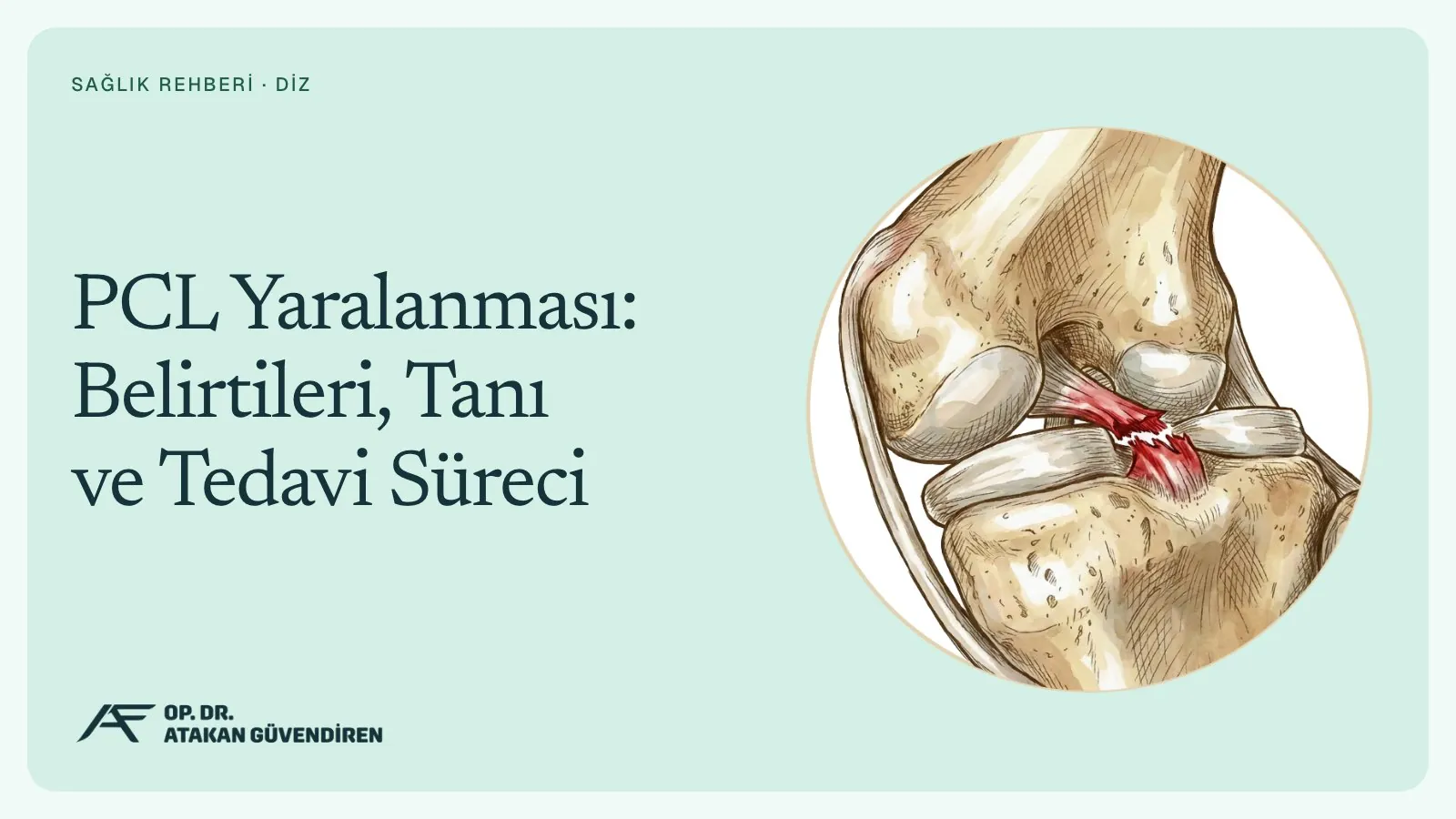 PCL Yaralanması: Belirtileri, Tanı ve Tedavi Süreci