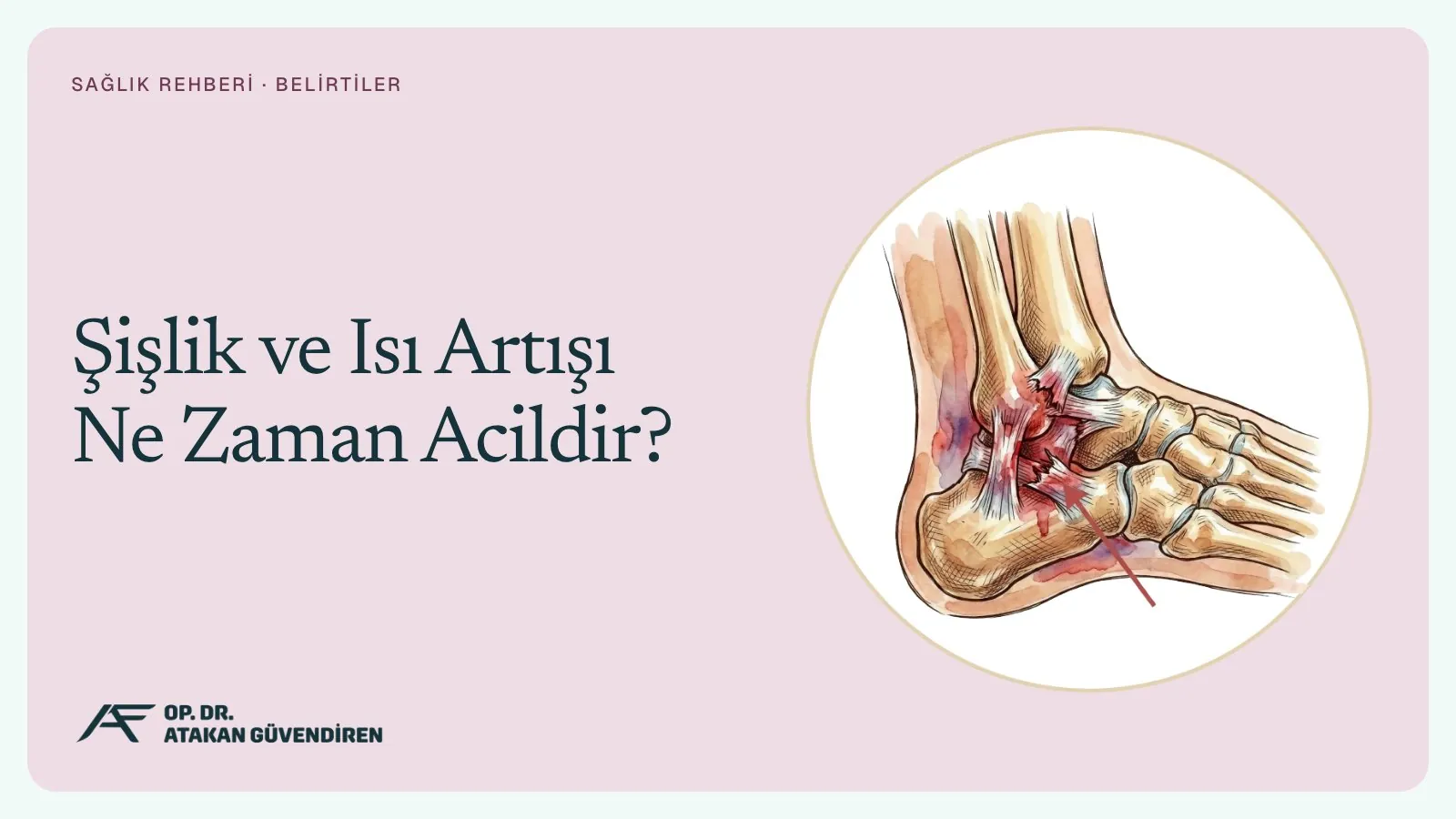 Şişlik ve Isı Artışı Ne Zaman Acildir?