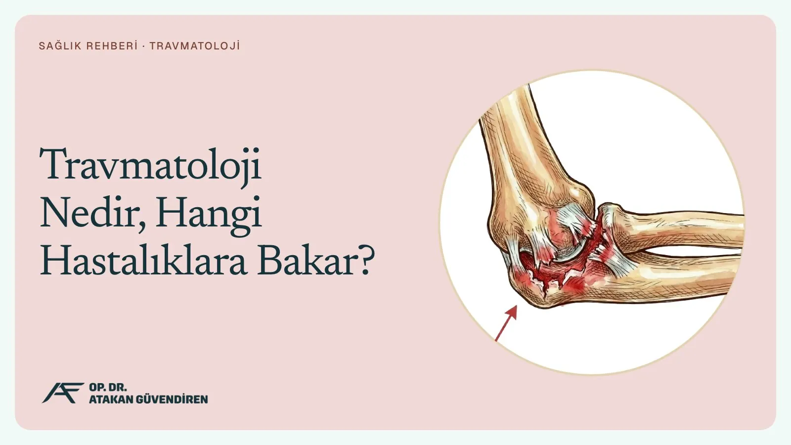 Travmatoloji Nedir, Hangi Hastalıklara Bakar?